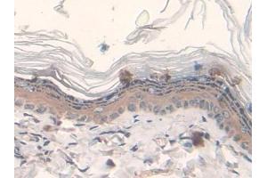 Detection of FASN in Rat Skin Tissue using Polyclonal Antibody to Fatty Acid Synthase (FASN) (Fatty Acid Synthase antibody  (AA 2243-2505))