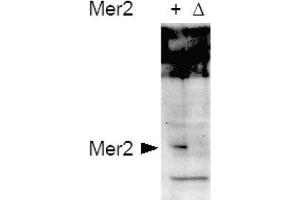 Image no. 1 for anti-CD151 (CD151) (AA 26-35), (pSer30) antibody (ABIN401337) (CD151 antibody  (pSer30))