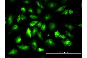 Immunofluorescence (IF) image for anti-Keratin 18 (KRT18) (AA 1-430) antibody (ABIN561633)
