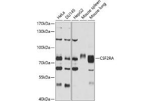 Western blot analysis of extracts of various cell lines, using CSF2RA antibody (ABIN3022748, ABIN3022749, ABIN1512778 and ABIN6219208) at 1:1000 dilution. (CSF2RA antibody  (AA 23-320))