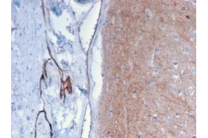 Formalin-fixed, paraffin-embedded human Brain stained with Drebrin-1 Mouse Monoclonal Antibody (DBN1/2879). (DBN1 antibody  (AA 150-281))