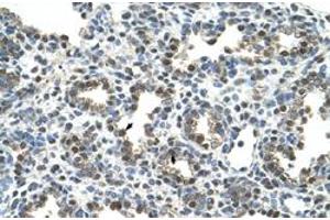 Immunohistochemical staining (Formalin-fixed paraffin-embedded sections) of human lung with GPNMB polyclonal antibody  at 4-8 ug/mL working concentration. (Osteoactivin antibody  (N-Term))
