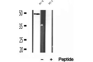 Western blot analysis of extracts of PC-3 cells, using SUCLA2 antibody. (SUCLA2 antibody  (Internal Region))