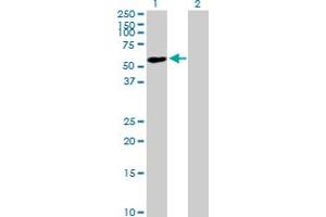 Western Blot analysis of ZNF565 expression in transfected 293T cell line by ZNF565 MaxPab polyclonal antibody. (ZNF565 antibody  (AA 1-499))