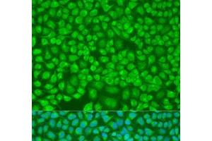 Immunofluorescence analysis of U2OS cells using PNKD Polyclonal Antibody at dilution of 1:100. (PNKD antibody)