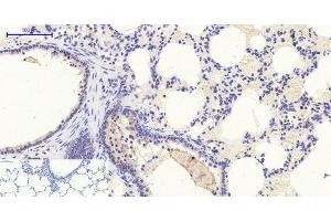 Immunohistochemistry of paraffin-embedded Rat lung tissue with Phospho-Stat1 (Tyr701) Polyclonal Antibody at dilution of 1:200 (STAT1 antibody  (pTyr701))