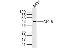 Western Blotting (WB) image for anti-Keratin 18 (KRT18) antibody (ABIN5005981)