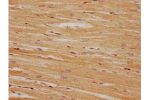 IHC image of ABIN7165960 diluted at 1:100 and staining in paraffin-embedded human heart tissue performed on a Leica BondTM system. (PPM1L antibody  (AA 128-343))