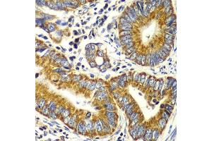 Immunohistochemistry (Paraffin-embedded Sections) (IHC (p)) image for anti-Mitochondrial Import Receptor Subunit TOM20 homolog (TOMM20) (AA 20-145) antibody (ABIN6149382)