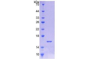 Image no. 1 for ATG7 Autophagy Related 7 (ATG7) (AA 429-488) protein (His tag) (ABIN1878633)