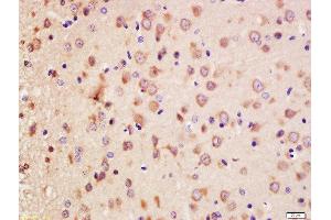 Formalin-fixed and paraffin embedded rat brain labeled with Anti-Erbin Polyclonal Antibody, Unconjugated  at 1:200 followed by conjugation to the secondary antibody and DAB staining. (ERBB2IP antibody  (AA 21-120))