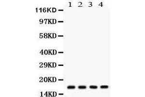 Western Blotting (WB) image for anti-Stathmin 1 (STMN1) (AA 2-34), (N-Term) antibody (ABIN3043301) (Stathmin 1 antibody  (N-Term))