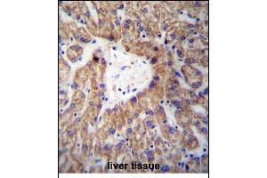 GLYAT Antibody (Center) (ABIN656988 and ABIN2846171) immunohistochemistry analysis in formalin fixed and paraffin embedded human liver tissue followed by peroxidase conjugation of the secondary antibody and DAB staining. (GLYAT antibody  (AA 171-199))