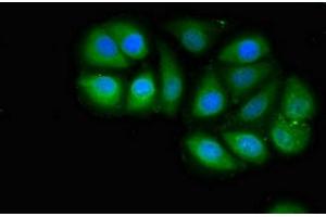 Immunofluorescent analysis of A549 cells using ABIN7159160 at dilution of 1:100 and Alexa Fluor 488-congugated AffiniPure Goat Anti-Rabbit IgG(H+L) (MED4 antibody  (AA 167-270))