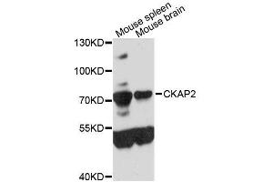 Western blot analysis of extracts of various cell lines, using CKAP2 antibody (ABIN5996642) at 1:3000 dilution. (CKAP2 antibody)