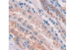 IHC-P analysis of Human Tissue, with DAB staining. (HYAL1 antibody  (AA 22-435))
