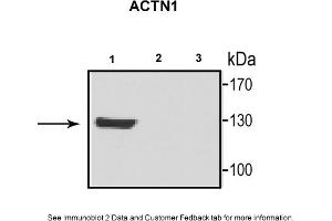 Sample Type: 1. (ACTN1 antibody  (N-Term))