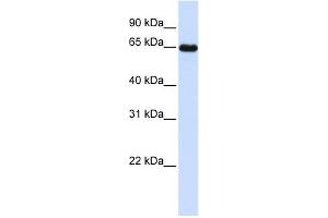 Leiomodin 1 antibody used at 1 ug/ml to detect target protein.