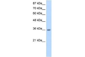 WB Suggested Anti-RP11-78J21. (HNRNPA1L2 antibody  (N-Term))