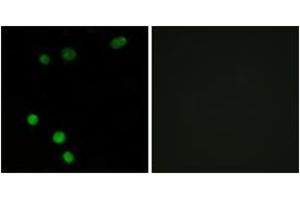 Immunofluorescence (IF) image for anti-Tumor Protein P53 Inducible Nuclear Protein 2 (TP53INP2) (AA 1-50) antibody (ABIN2889668) (TP53INP2 antibody  (AA 1-50))