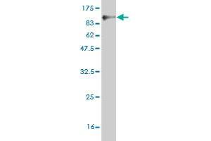 Western Blot detection against Immunogen (85. (UBP1 antibody  (AA 1-540))