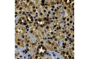Immunohistochemical analysis of Myosin Ic staining in rat kidney formalin fixed paraffin embedded tissue section. (Myosin IC antibody)