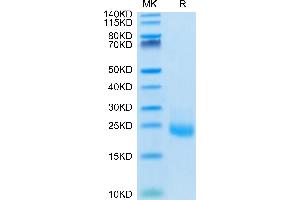 IL-31 Protein (AA 24-164) (His tag)