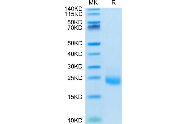 IL-31 Protein (AA 24-164) (His tag)