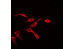 ABIN6269398 staining 293 by IF/ICC. (WNK1 antibody  (N-Term))