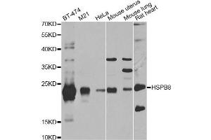 Western blot analysis of extracts of various cell lines, using HSPB8 antibody (ABIN5971347) at 1/1000 dilution.