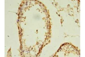 Immunohistochemistry of paraffin-embedded human testis tissue using ABIN7152293 at dilution of 1:100 (EXOSC5 antibody  (AA 1-235))