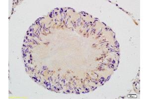 Formalin-fixed and paraffin embedded rat testis labeled with Rabbit Anti-GAPDHS/GAPDH2 Polyclonal Antibody, Unconjugated  at 1:200 followed by conjugation to the secondary antibody and DAB staining (GAPDHS antibody  (AA 251-350))