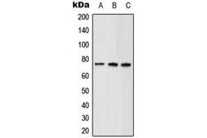 Western blot analysis of ABCD1 expression in HeLa (A), mouse brain (B), rat kidney (C) whole cell lysates. (ABCD1 antibody  (Center))