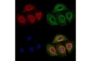 ABIN6257891 and ABIN6273815 staining Hela cells by IF/ICC. (TRIO antibody  (Internal Region))