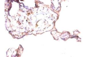 Immunohistochemistry of paraffin-embedded human placenta tissue using ABIN7144088 at dilution of 1:50 (Angiopoietin 1 antibody  (AA 16-498))