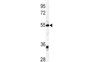 Western Blotting (WB) image for anti-Growth Differentiation Factor 6 (GDF6) antibody (ABIN3003243) (GDF6 antibody)