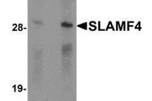 Western blot analysis of SLAMF4 in Daudi cell lysate with SLAMF4 antibody at (left) 1 and (right) 2 μg/ml.