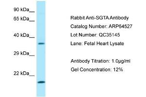 Western Blotting (WB) image for anti-Small Glutamine-Rich Tetratricopeptide Repeat (TPR)-Containing, alpha (SGTA) (C-Term) antibody (ABIN2789863) (SGTA antibody  (C-Term))