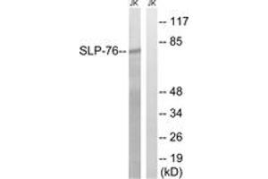 Western blot analysis of extracts from Jurkat cells, treated with EGF 200ng/ml 5', using SLP-76 (Ab-128) Antibody. (LCP2 antibody  (AA 94-143))