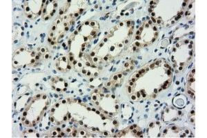 Image no. 10 for anti-5'-Nucleotidase Domain Containing 1 (NT5DC1) antibody (ABIN1499838)