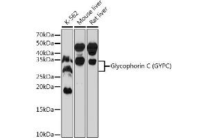 Western blot analysis of extracts of various cell lines, using Glycophorin C (GYPC) (GYPC) Rabbit mAb (ABIN7267476) at 1:1000 dilution. (CD236/GYPC antibody)