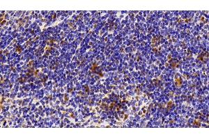 Immunohistochemistry (IHC) image for anti-High Mobility Group Box 1 (HMGB1) (AA 1-215) antibody (ABIN7431743)