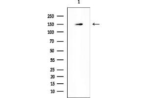 anti-Diaphanous Homolog 1 (DIAPH1) (N-Term) antibody