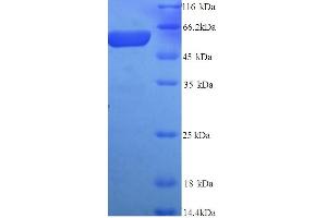 SDS-PAGE (SDS) image for Glypican 3 (GPC3) (AA 25-560), (partial) protein (His tag) (ABIN5713474)
