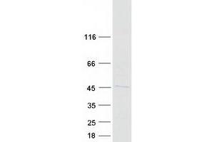 Required For Meiotic Nuclear Division 5 Homolog B (RMND5B) protein (Myc-DYKDDDDK Tag)