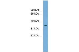 WB Suggested Anti-C3orf49 Antibody Titration: 0. (C3orf49 antibody  (Middle Region))