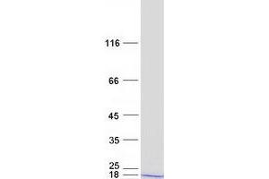 Validation with Western Blot (RPL24 Protein (Myc-DYKDDDDK Tag))