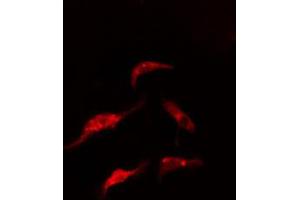 ABIN6274864 staining HeLa cells by IF/ICC.