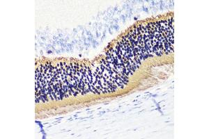 Immunohistochemistry of paraffin-embedded rat retina using PDC antibody (ABIN6132871, ABIN6145332, ABIN6145333 and ABIN6224509) at dilution of 1:200 (40x lens). (Phosducin antibody  (AA 1-246))