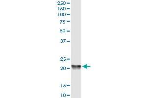 PBP monoclonal antibody (M01), clone 2G2-1F1. (PEBP1 antibody  (AA 1-187))